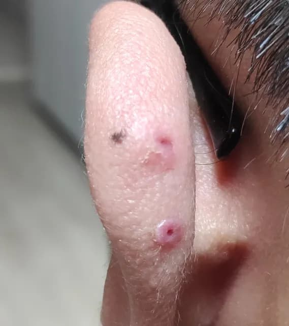 살튀 패드 착용 8주간의 기록-11