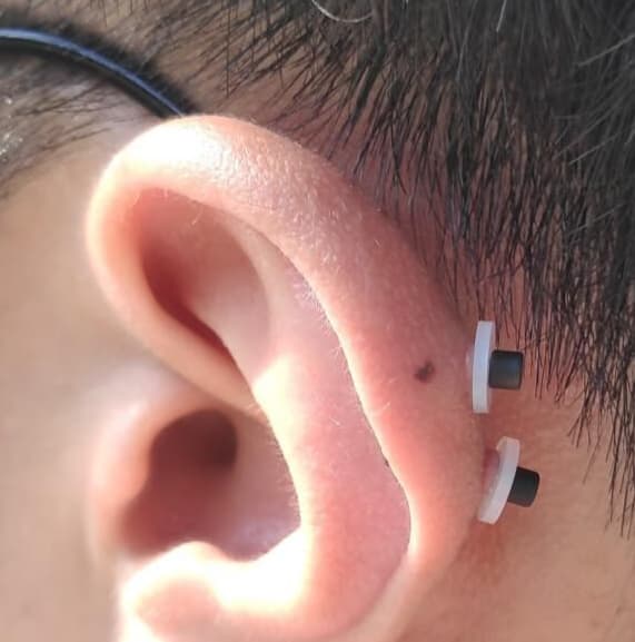 살튀 패드 착용 8주간의 기록-4