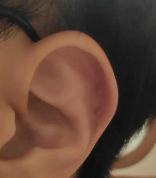 살튀 패드 착용 8주간의 기록-6