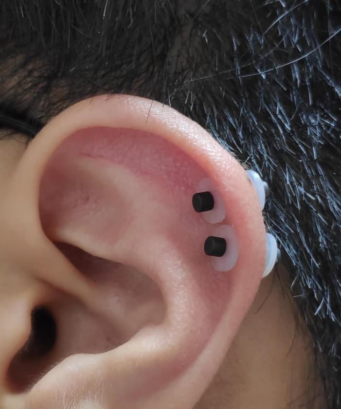 살튀 패드 착용 8주간의 기록-7