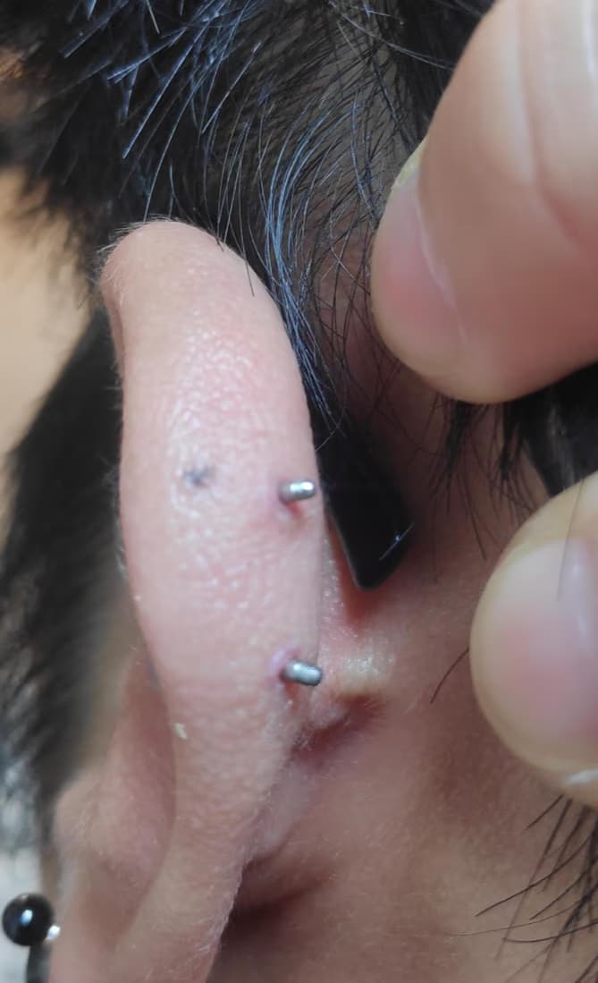 살튀 패드 착용 8주간의 기록-9