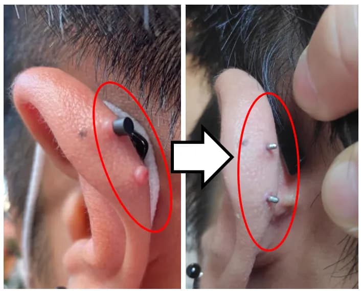 살튀 패드 착용 8주간의 기록-10