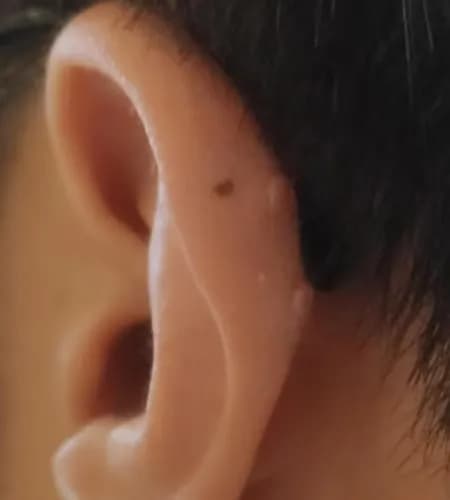 살튀 패드 착용 8주간의 기록-5