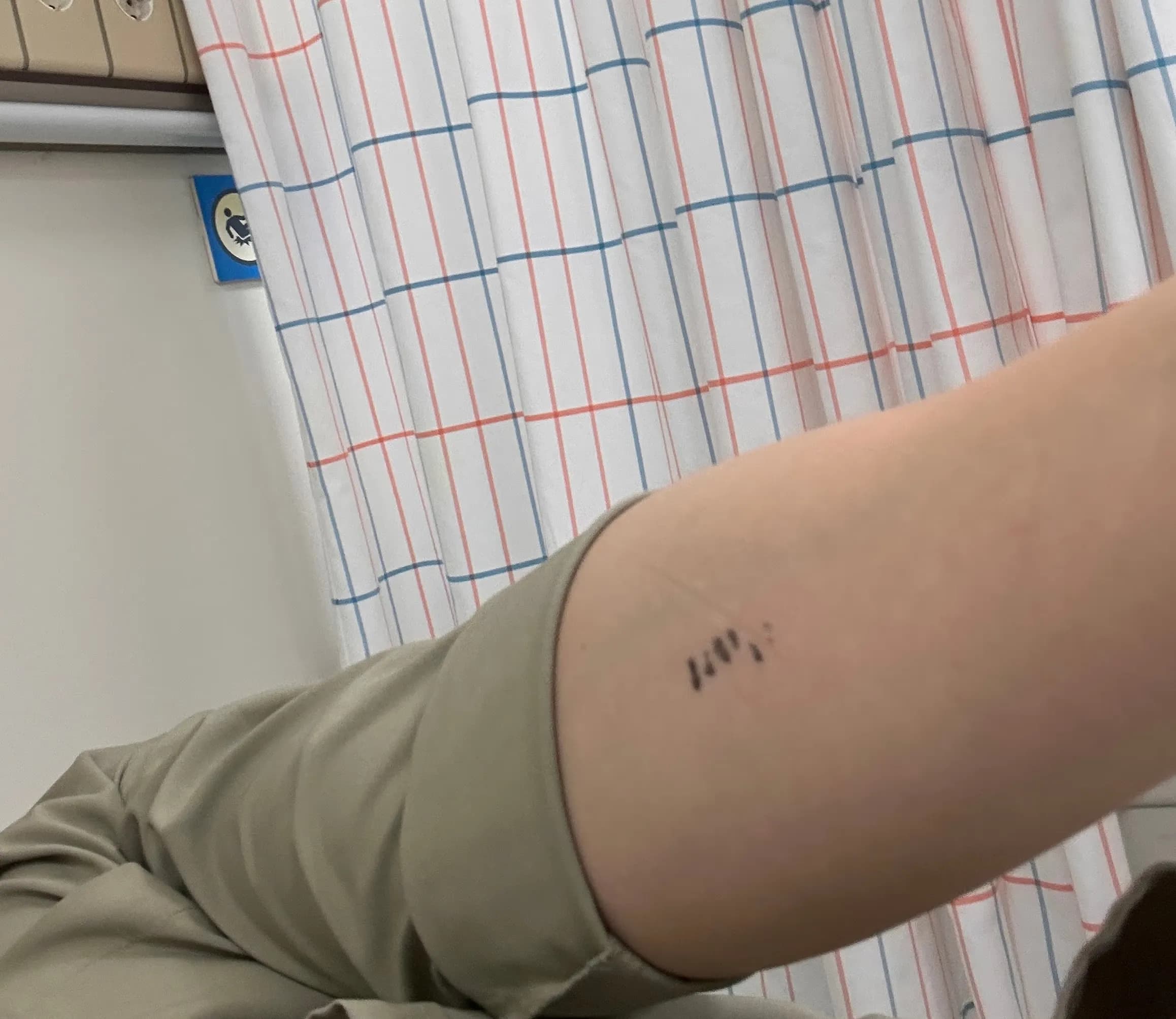 Sanggye Paik Hospital ER Review – Criteria for Stitches, Dressing Method, and Healing Time for Stitched Wounds-10