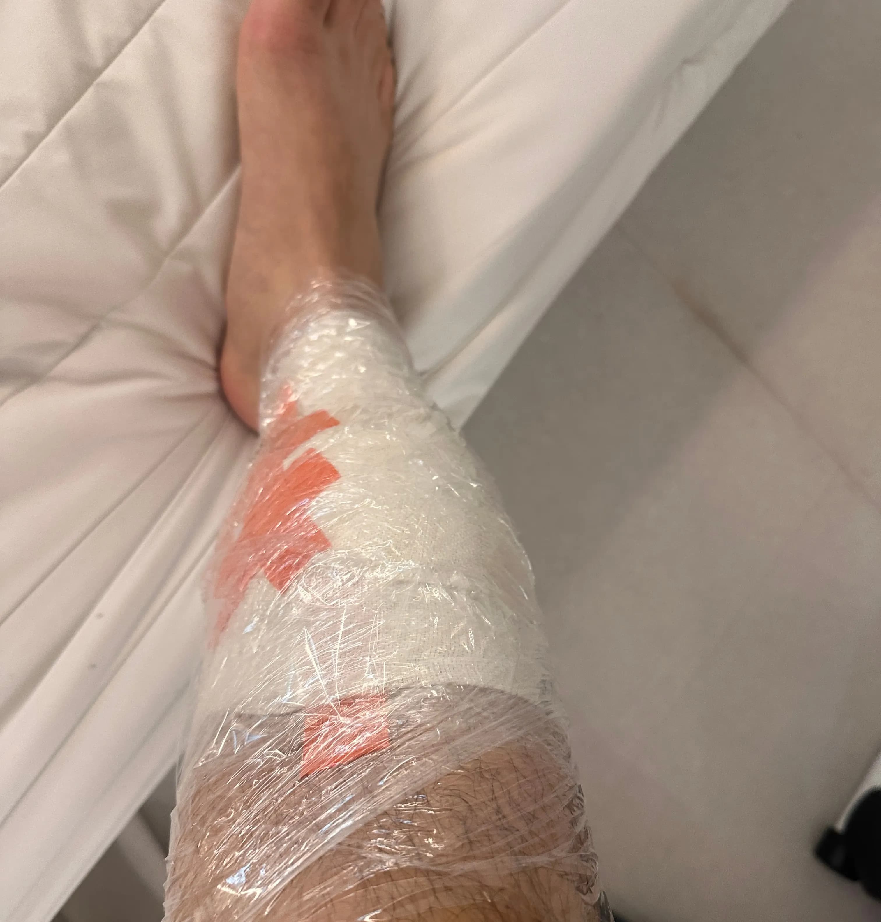 Sanggye Paik Hospital ER Review – Criteria for Stitches, Dressing Method, and Healing Time for Stitched Wounds-12