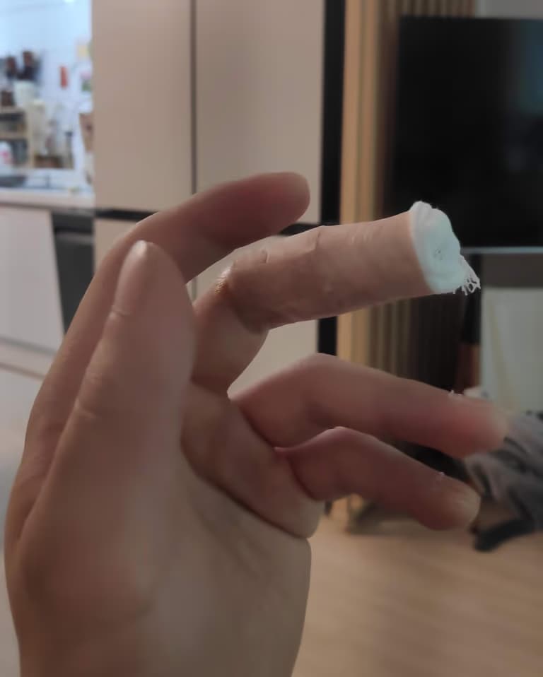 칼에 베인 상처 회복 기간