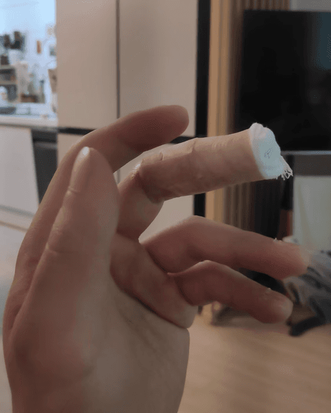 칼에 베인 상처 회복 기간