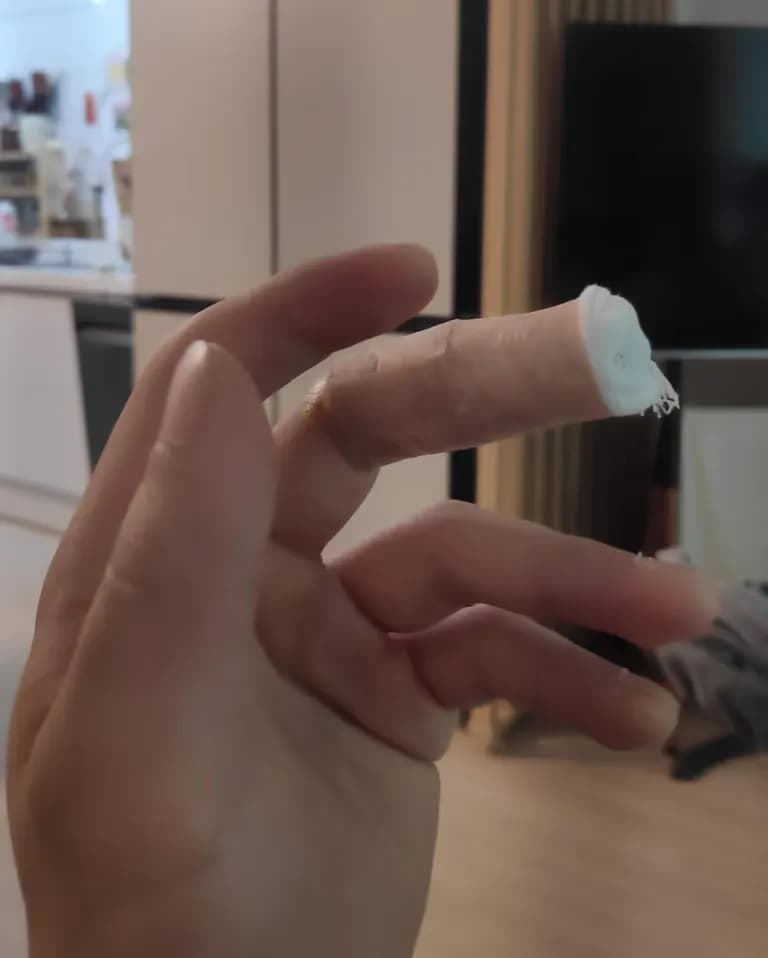 칼에 베인 상처 회복 기간-1