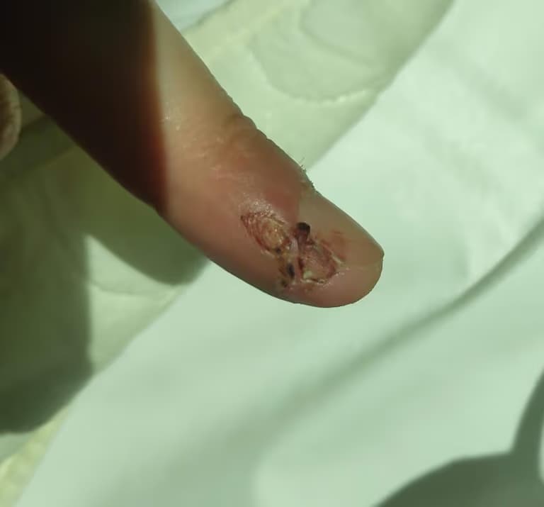 칼에 베인 상처 회복 기간-6