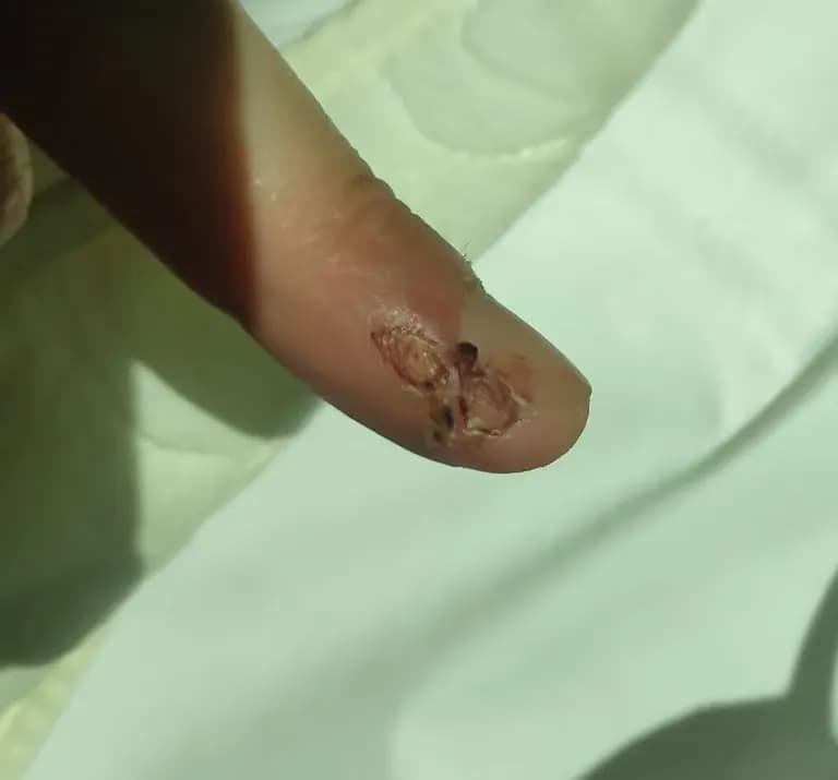 칼에 베인 상처 회복 기간-6