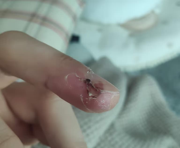 칼에 베인 상처 회복 기간-8