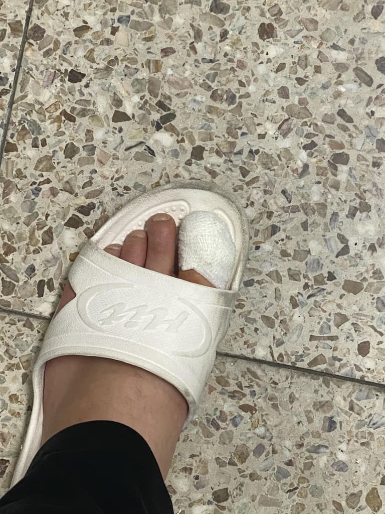 발가락 결절종 수술 후기, 수술 상처 관리 방법-3