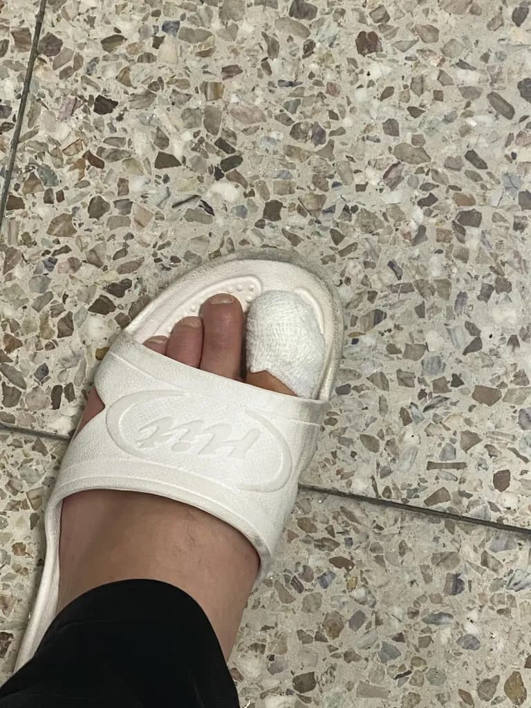 발가락 결절종 수술 후기, 수술 상처 관리 방법-3