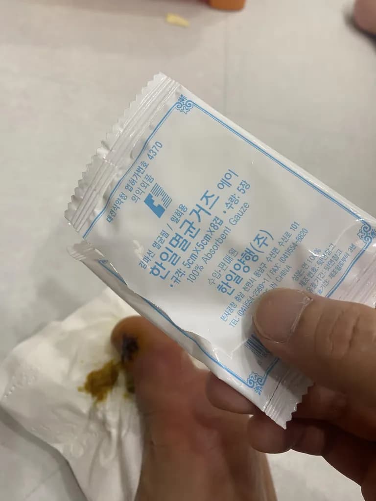 발가락 결절종 수술 후기, 수술 상처 관리 방법-8