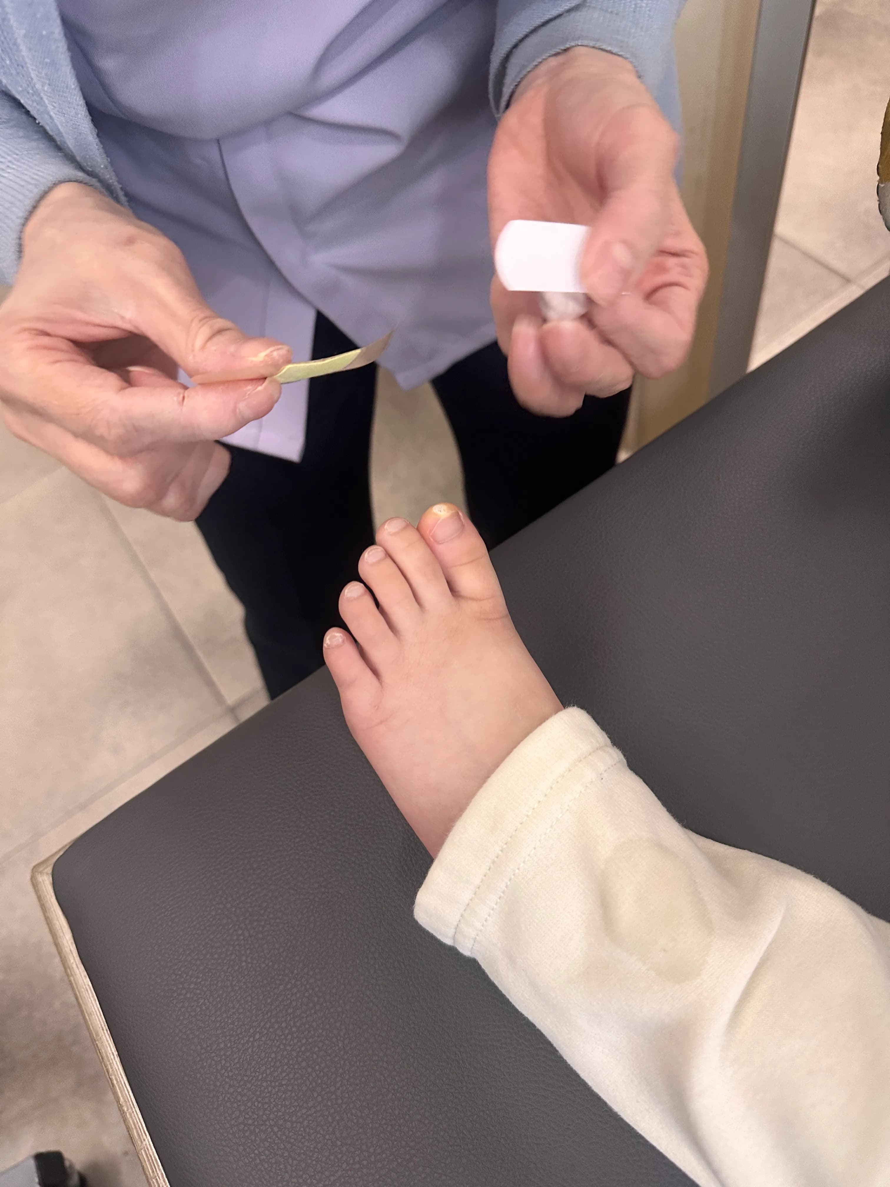 만4세 아기 발가락 사마귀 제거 후기-7